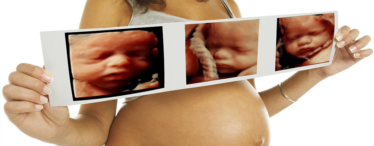 Ultrasound Packages | 3D 4D HD LIVE Elective Ultrasound | Pueblo, CO